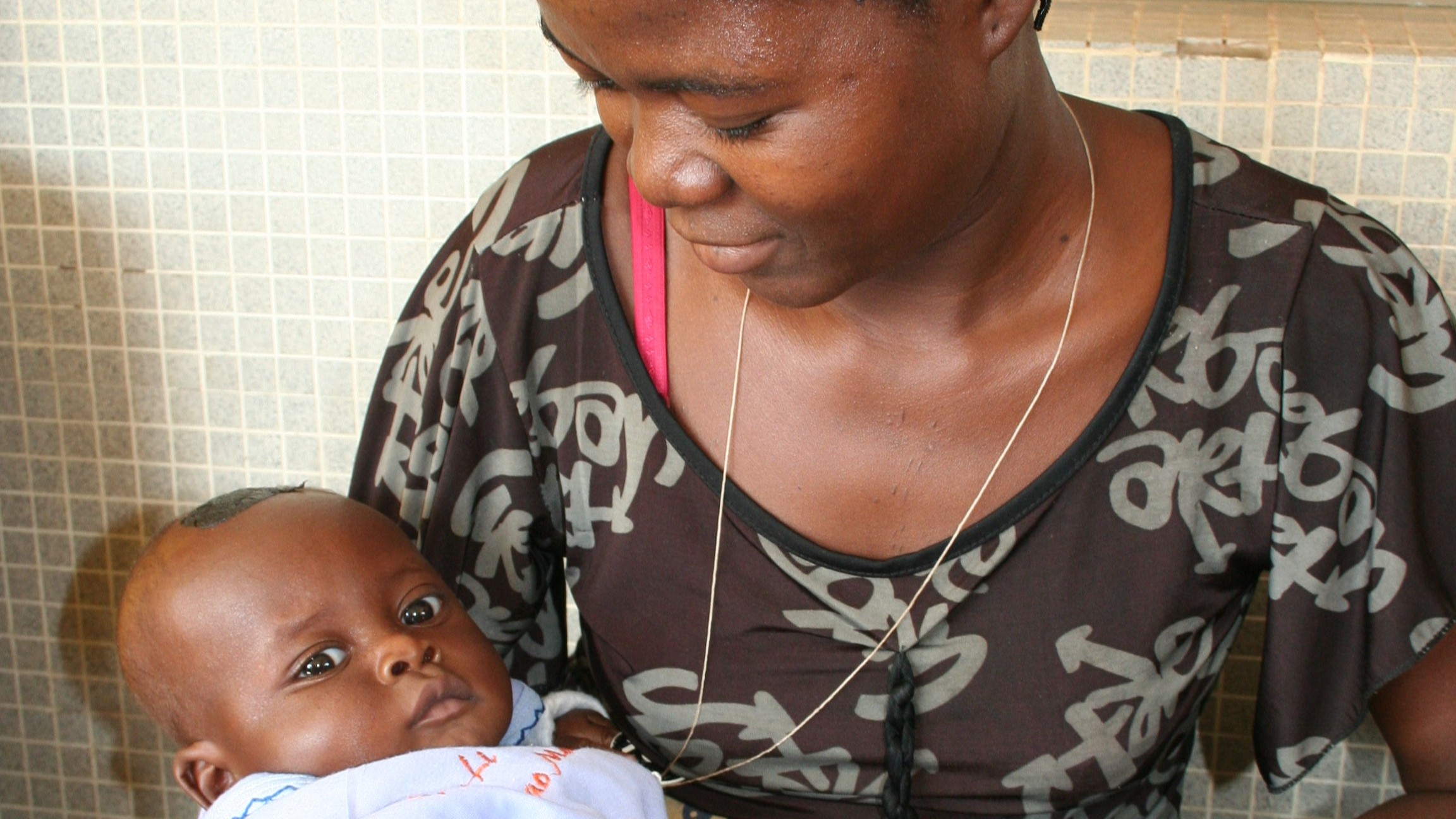 The impact of the NEST Model at Saint Jean de Dieu Hospital in Tanguiéta